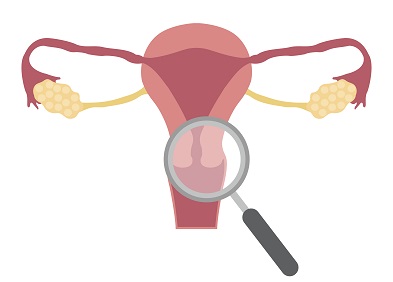 vaginite dyspareunie atrophie vaginale infection penetration douloureuse
